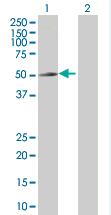 All lanes : Anti-SNX17 antibody (ab67599) at 1/500 dilutionLane 1 : SNX17 transfected 293T lysateLane 2 : Non transfected 293T lysateLysates/proteins at 25 µg per lane.SecondaryGoat Anti-Mouse IgG (H&L)-HRP Conjugate at 1/2500 dilution