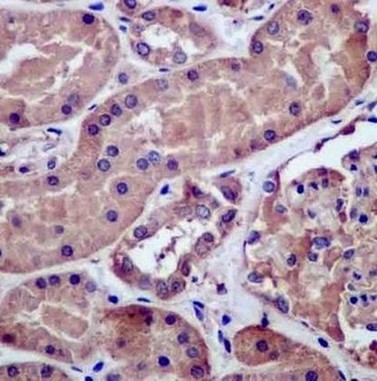 Immunohistochemical analysis of paraffin embedded Human kidney tissue labeling SNX29 with ab180591 at 1/100.