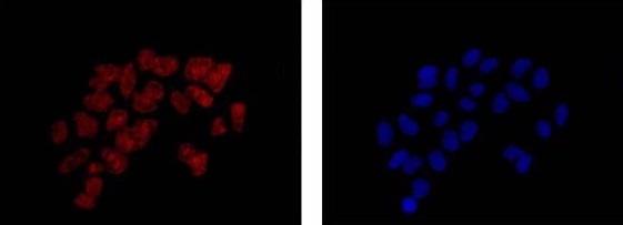 Immunofluorescent analysis of 4% paraformaldehyde fixed HeLa cells labeling SNX29 with ab180591 at 1/100 and dye conjugated secondary Goat anti rabbit IgG at 1/200 (red). Dapi staining is showed in blue.