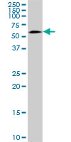 Anti-SNX4 antibody (ab88344) at 1 µg/ml + HepG2 cell lysate at 25 µgSecondaryGoat anti-mouse IgG (H&L)-HRP conjugate at 1/2500 dilution
