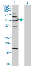 All lanes : Anti-SNX4 antibody (ab88344) at 1 µg/mlLane 1 : SNX4 transfected 293T cell lysateLane 2 : Non-transfected 293T cell lysateLysates/proteins at 25 µg per lane.SecondaryGoat anti-mouse IgG (H&L)-HRP conjugate at 1/2500 dilution