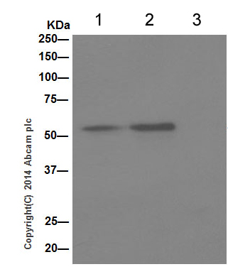 Western blot analysis of immunoprecipitation pellet from 1 mg 293 whole cell lysate immunoprecipitated using ab198504 at 1/40 dilution.Lane 1 (Input): 293 whole cell lysate 10µg.Lane 2 (+) : 293 whole cell lysate using ab198504 at 1/1000 dilution.Lane 3 (-) : 293 whole cell lysate using Rabbit monoclonal IgG (ab172730) instead of ab198504.Secondary: Anti-Rabbit IgG (HRP), specific to the non-reduced form of IgG at 1/1500 dilution.