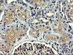 ab119388 at 1/150 dilution staining SNX8 in Paraffin-embedded Human Kidney tissue by Immunohistochemistry.