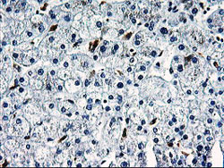ab119388 at 1/150 dilution staining SNX8 in Paraffin-embedded Human Liver tissue by Immunohistochemistry.