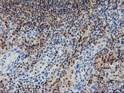 ab119388 at 1/150 dilution staining SNX8 in Paraffin-embedded Human tonsil tissue by Immunohistochemistry.