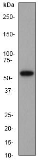 Anti-SOAT 1 antibody [EP1376Y] (ab53008) at 1/10000 dilution + U937 cell lysate at 10 µgSecondarygoat anti-rabbit HRP labelled at 1/2000 dilution