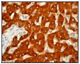 ab53008, at a 1/250 dilution, staining Human SOAT 1 in Liver using Immunohistochemistry, Paraffin embedded tissue.