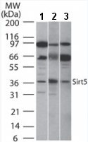 All lanes : Anti-SIRT5 antibody (ab13697) at 2 µg/mlLane 1 : Human intestine cell lysateLane 2 : Mouse intestine cell lysateLane 3 : Rat intestine cell lysateObserved band size : 36 kDa (why is the actual band size different from the predicted?)