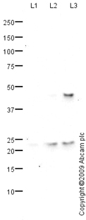 All lanes : Anti-SOCS1 antibody (ab77072) at 1 µg/mlLane 1 : Spleen (Human) Tissue Lysate - adult normal tissue (ab29699)Lane 2 : Small Intestine (Human) Tissue Lysate - adult normal tissue (ab29276)Lane 3 : MOLT4 (Human acute lymphoblastic leukemia cell line) Whole Cell LysateLysates/proteins at 10 µg per lane.SecondaryGoat polyclonal to Rabbit IgG - H&L - Pre-Adsorbed (HRP) at 1/3000 dilutiondeveloped using the ECL techniquePerformed under reducing conditions.