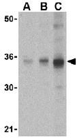 Lane 1 :  Anti-SOCS1 antibody (ab37167) at 1 µg/mlLane 2 :  Anti-SOCS1 antibody (ab37167) at 2 µg/mlLane 3 :  Anti-SOCS1 antibody (ab37167) at 4 µg/mlLane 1 : Human spleen cell lysateLane 2 : Human spleen cell lysateLane 3 : Human spleen cell lysateLysates/proteins at 15 µg per lane.Secondarygoat anti-rabbit HRP at 1/10000 dilution