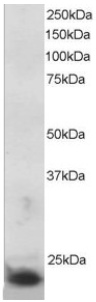 Anti-SOCS3 antibody (ab723) at 5 µg/ml + MOLT-4 lysate (RIPA buffer, 30µg total protein per lane)Observed band size : 24 kDa (why is the actual band size different from the predicted?)