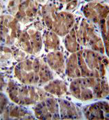 Immunohistochemical analysis of formalin-fixed, paraffin-embedded Human stomach tissue labeling SOCS4 with ab170436 at 1/10 dilution followed by peroxidase conjugation of the secondary antibody and DAB staining.