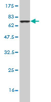 Western blot against tagged recombinant protein immunogen using ab57337 SOCS4 antibody at 1ug/ml.