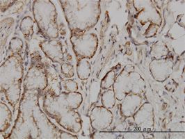 SOCS5 antibody (ab56649) used in immunohistochemistry at 3ug/ml on formalin fixed and paraffin embedded human smooth muscle.