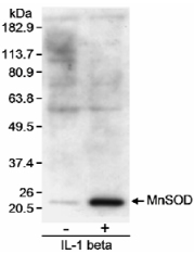 Detection of MnSOD by Western Blot. Samples: Whole cell lysate (30 mcg) from rat vascular smooth muscle cells treated with IL1 beta (3 ng/ml) for 24 hours (+) or untreated (-). Antibody: Affinity purified goat anti-MnSOD (BL468G) used at 0.4 mcg/ml. Detection: Chemiluminescence with 3 minute exposure.