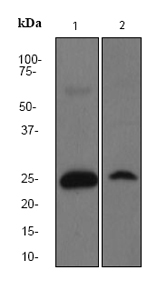 All lanes : Anti-SOD2 antibody [EPR2560Y] (ab68155) at 1/500 dilutionLane 1 : Rat brain lysateLane 2 : SH-SY5Y lysateLysates/proteins at 10 µg per lane.SecondaryHRP labelled goat anti-rabbit at 1/2000 dilution