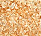 ab68155 at 1:100 dilution staining Superoxide Dismutase 2 in human liver tissue sections.