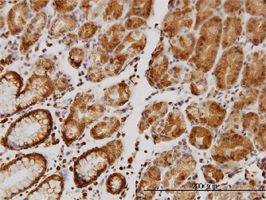 Sodium / Hydrogen Exchanger 1 antibody (ab58304) used in immunohistochemistry at 3ug/ml on formalin fixed and paraffin embedded human stomach.