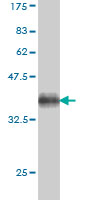 Western blot against tagged recombinant protein immunogen using ab58304 Sodium / Hydrogen Exchanger 1 antibody at 1ug/ml. 