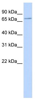 Anti-Sodium Iodide Symporter antibody (ab83816) at 1 µg/ml (in 5% skim milk / PBS buffer) + 293T cell lysateSecondaryHRP conjugated anti-Rabbit IgG at 1/50000 dilution