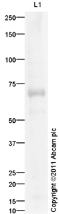 Anti-Sodium Iodide Symporter antibody (ab101084) at 1 µg/ml + Thyroid (Human) Whole Cell Lysate - adult normal tissue (ab29636) at 20 µgSecondaryGoat Anti-Rabbit IgG H&L (HRP) preadsorbed (ab97080) at 1/5000 dilutiondeveloped using the ECL techniquePerformed under reducing conditions.