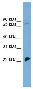 Anti-Sodium Iodide Symporter antibody (ab104716) at 1 µg/ml + COLO205 cell lysate at 10 µg