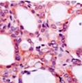 Human thyroid stained with anti-hNIS (ab17950).