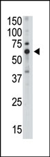Anti-SIGLEC5 antibody (ab38582) at 1/100 dilution + Mouse liver tissue lysate