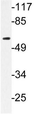 Anti-soluble IL2 Receptor beta antibody (ab134754) at 1/500 dilution + RAW 264.7 cell extract at 30 µg