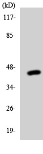 Anti-Soluble TNF Receptor II antibody (ab137225) at 1/500 dilution + HUVEC cell lysate at 30 µg