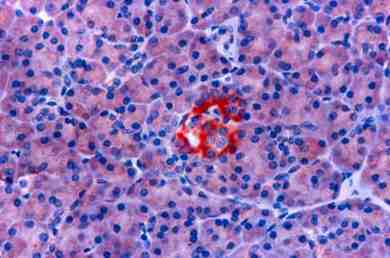 Formalin fixed paraffin embedded human pancreas stained with Somatostatin Receptor using ABC and AEC chromogen.