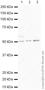All lanes : Anti-Somatostatin Receptor 1 antibody (ab2366) at 1 µg/mlLane 1 : PANC-1 (Human pancreatic carcinoma, epithelial-like cell line) Nuclear Lysate (ab14882)Lane 2 : Stomach (Human) Whole Cell Lysate - tumor tissue (ab29678)Lane 3 : Small Intestine (Human) Tissue Lysate - adult normal tissue (ab29276)Lysates/proteins at 10 µg per lane.SecondaryGoat polyclonal to Rabbit IgG - H&L - Pre-Adsorbed (HRP) at 1/3000 dilutiondeveloped using the ECL techniquePerformed under reducing conditions.