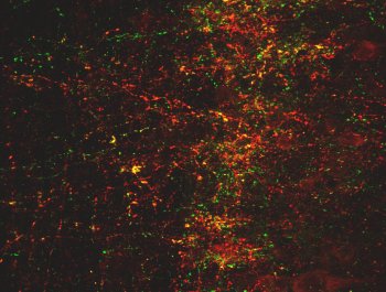 ab100881 at 1/5000 showing dual labeling of anti-sst1 (green) and somatostatin (red). Anti-Sst1 shows sst1 in neuronal terminals co-localized with somatostatin