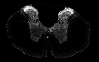 ab100881 showing anti-Sst1 depicts sst1 as a presynaptic receptor in the superficial layers of the spinal cord dorsal horn