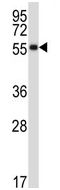 Anti-Somatostatin Receptor 1 antibody (ab116447) at 1/100 dilution + Mouse kidney tissue lysates at 35 µg