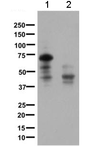All lanes : Anti-Somatostatin Receptor 1 antibody [UMB7] (ab137083) at 1/500 dilutionLane 1 : Human fetal lung lysatesLane 2 : Human small intestine lysatesLysates/proteins at 10 µg per lane.Secondarygoat anti-rabbit HRP at 1/2000 dilution