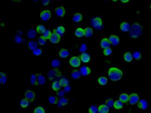 Immunofluorescent analysis of 2936E cells labelling Somatostatin Receptor 1 with ab137083 at 1/250 dilution.