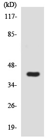 Anti-Somatostatin Receptor 1 antibody - N-terminal (ab138326) at 1/500 dilution + COLO205 cell lysate at 30 µg