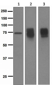 All lanes : Anti-Somatostatin Receptor 2 antibody [UMB1] (ab134152) at 1/1000 dilutionLane 1 : U937 cell lysatesLane 2 : INS-1 cell lysatesLane 3 : sstr2 transfected HEK293 cell lysatesLysates/proteins at 10 µg per lane.SecondaryHRP labelled goat anti-rabbit at 1/2000 dilution