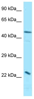 Anti-Somatostatin Receptor 3 antibody (ab125404) at 1 µg/ml + Fetal Kidney Lysate