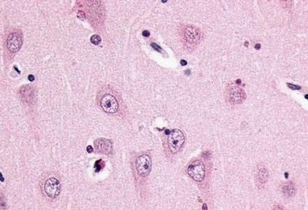 Immunohistochemical analysis of formalin fixed, paraffin embedded Human brain tissue (neurons of area ca1) labelling Somatostatin Receptor 3 with ab140939 at 15 µg/ml.