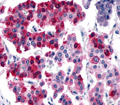 Immunohistochemical analysis of Formalin-fixed, Paraffin-Embedded Human pancreas, islet of Langerhans tissue labelling Somatostatin Receptor 4 with ab140995 at 6 µg/ml.