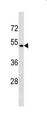 Anti-Somatostatin Receptor 5 antibody - C-terminal (ab138863) at 1/100 dilution + CEM cell line lysate at 35 µg