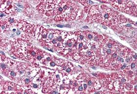 Immunohistochemical analysis of formalin-fixed, paraffin-embedded Human adrenal tissue labelling Somatostatin Receptor 5 with ab140922 at 10 µg/ml.