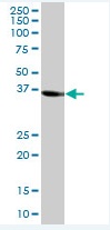 Anti-Sorbitol Dehydrogenase antibody (ab88509) at 1 µg/ml + Human liver lysate at 50 µg/ml