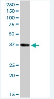 Anti-Sorbitol Dehydrogenase antibody (ab88509) at 1 µg/ml + Jurkat cell lysate at 50 µg