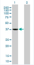 All lanes : Anti-Sorbitol Dehydrogenase antibody (ab88509) at 1 µg/mlLane 1 : Transfected 293T cell lysateLane 2 : Non-transfected 293T cell lysateLysates/proteins at 50 µg per lane.