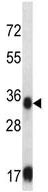 Anti-Sorbitol Dehydrogenase antibody (ab124078) at 1/100 dilution + Hela cell line lysate at 35 µg