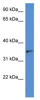 Anti-Sorbitol Dehydrogenase antibody (ab113874) at 1 µg/ml + HeLa cell lysate at 10 µg