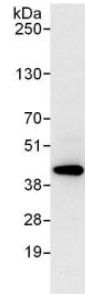 Immunoprecipitation from HeLa whole cell lysate (1 mg for IP, 20% of IP loaded), using ab123497 at 6 µg/mg lysate for IP.Subsequent Western blot detection used an antibody which recognized an downstream epitope of Sorbitol Dehydrogenase at 0.4 µg/ml.Detection: Chemiluminescence with an exposure time of 10 seconds